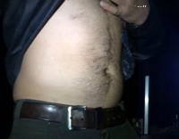 taze in the stomach next to bonfire